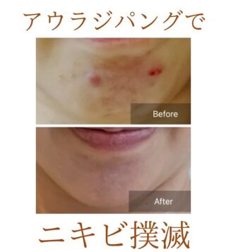リミーバウンダリーコンディショニング | AQUA+ アクアプラス